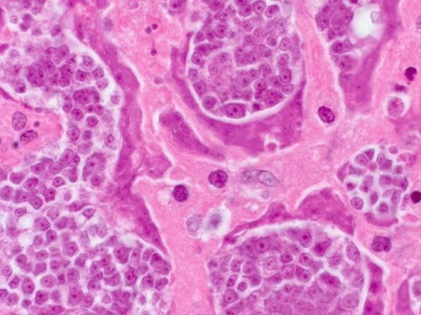 Parasitenforschung in einer Person