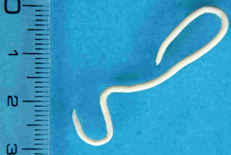 Beschreibung menschlicher Parasiten