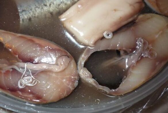 Infektionswege des Menschen durch Parasiten.