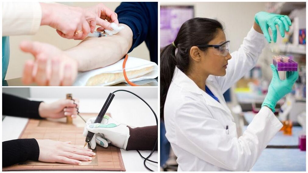 Diagnosemethoden zum Nachweis von Parasiten im Körper.