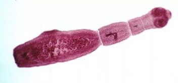 Wie man Parasiten im menschlichen Körper loswerden