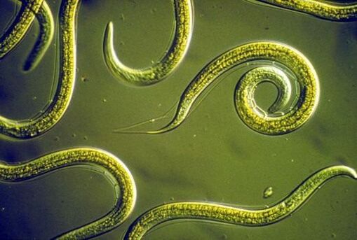 Parasitäre Nematoden im menschlichen Dünndarm